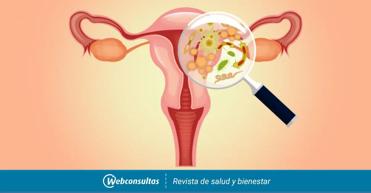 qué pasa cuando la flora bacteriana está aumentada - Qué significa flora bacteriana aumentada en un examen de heces